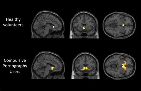 can porn cause brain fog|impact of porn on brain.